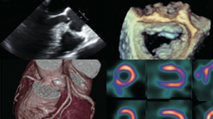 像診断を極める