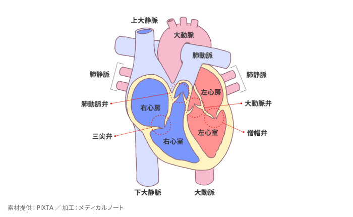 心臓弁膜症とはのイメージ
