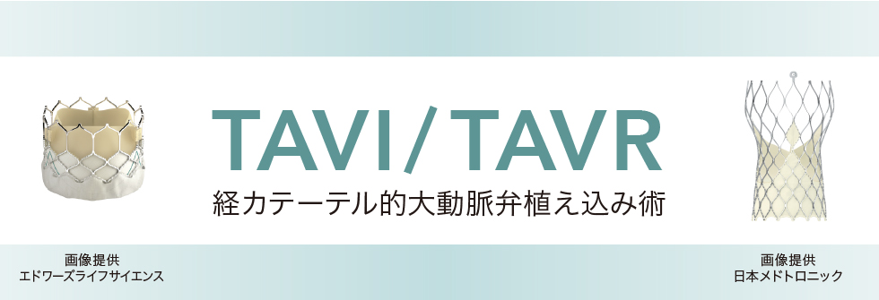 TAVI／TAVR