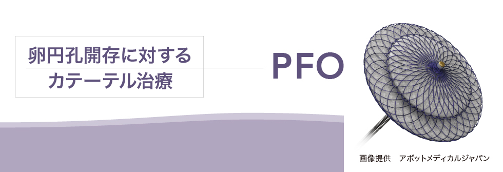 卵円孔開存に対するカテーテル治療